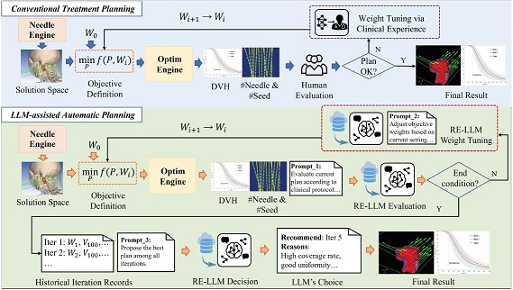 overview for An Iterative LLM Framework for SIBT utilizing RAG-based Adaptive Weight Optimization