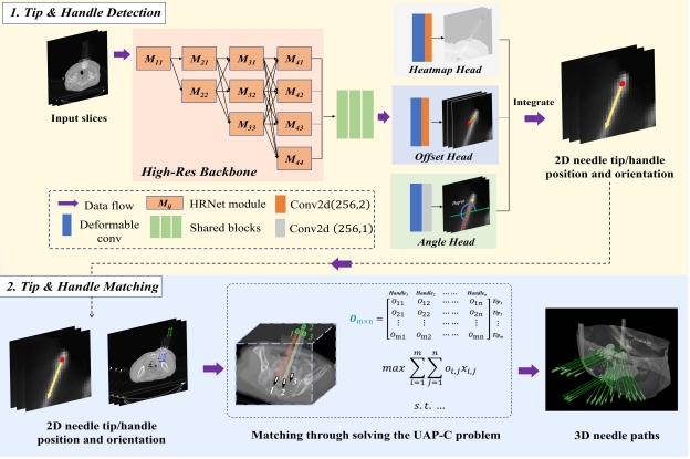 overview for Multi-needle Localization for Pelvic Seed Implant Brachytherapy based on Tip-handle Detection and Matching