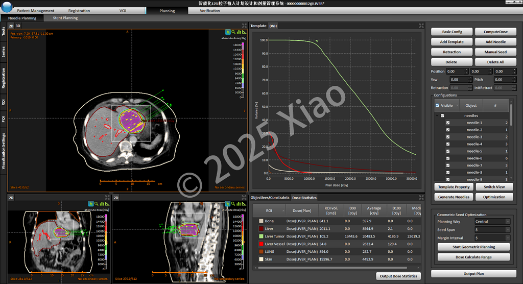 Treatment Planning System Planning